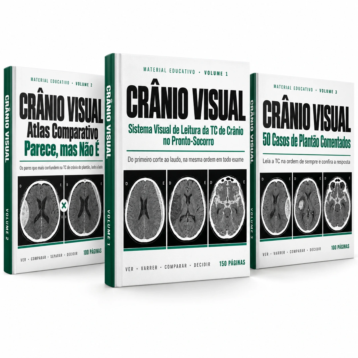 Crânio Visual: Sistema Visual, Atlas Comparativo e 50 Casos de Plantão Comentados