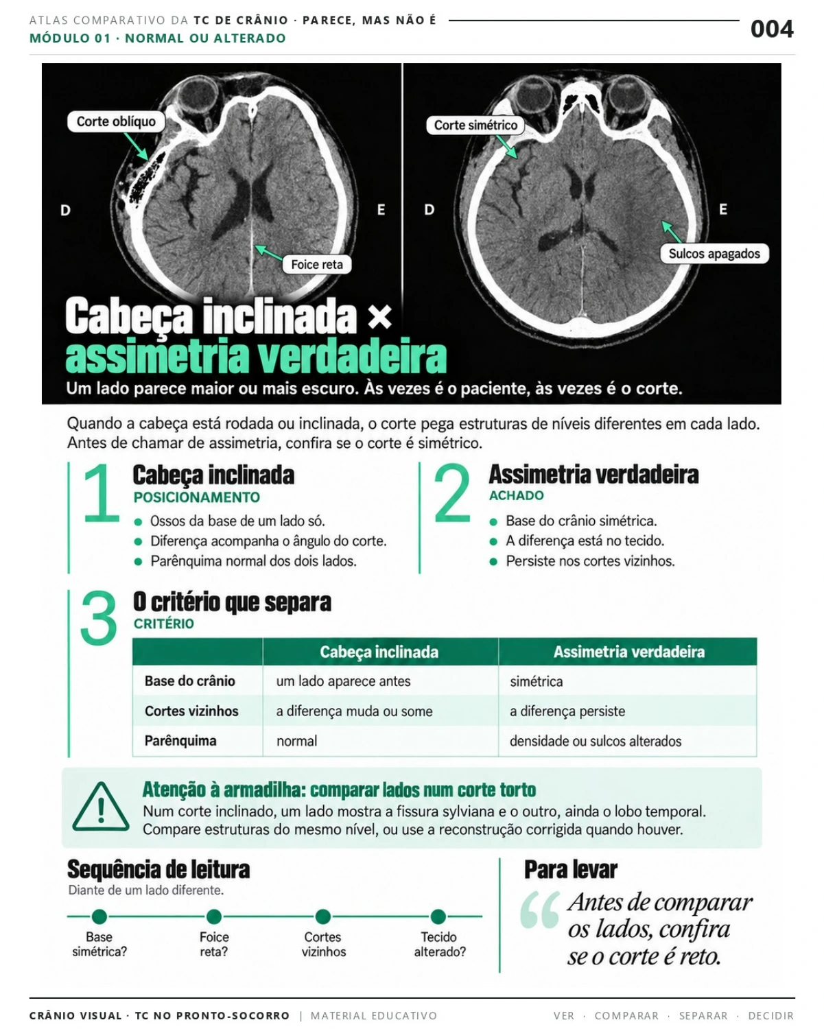 Página 4: Cabeça inclinada × assimetria verdadeira. Prévia do PDF Crânio Visual TC; imagens didáticas simuladas.
