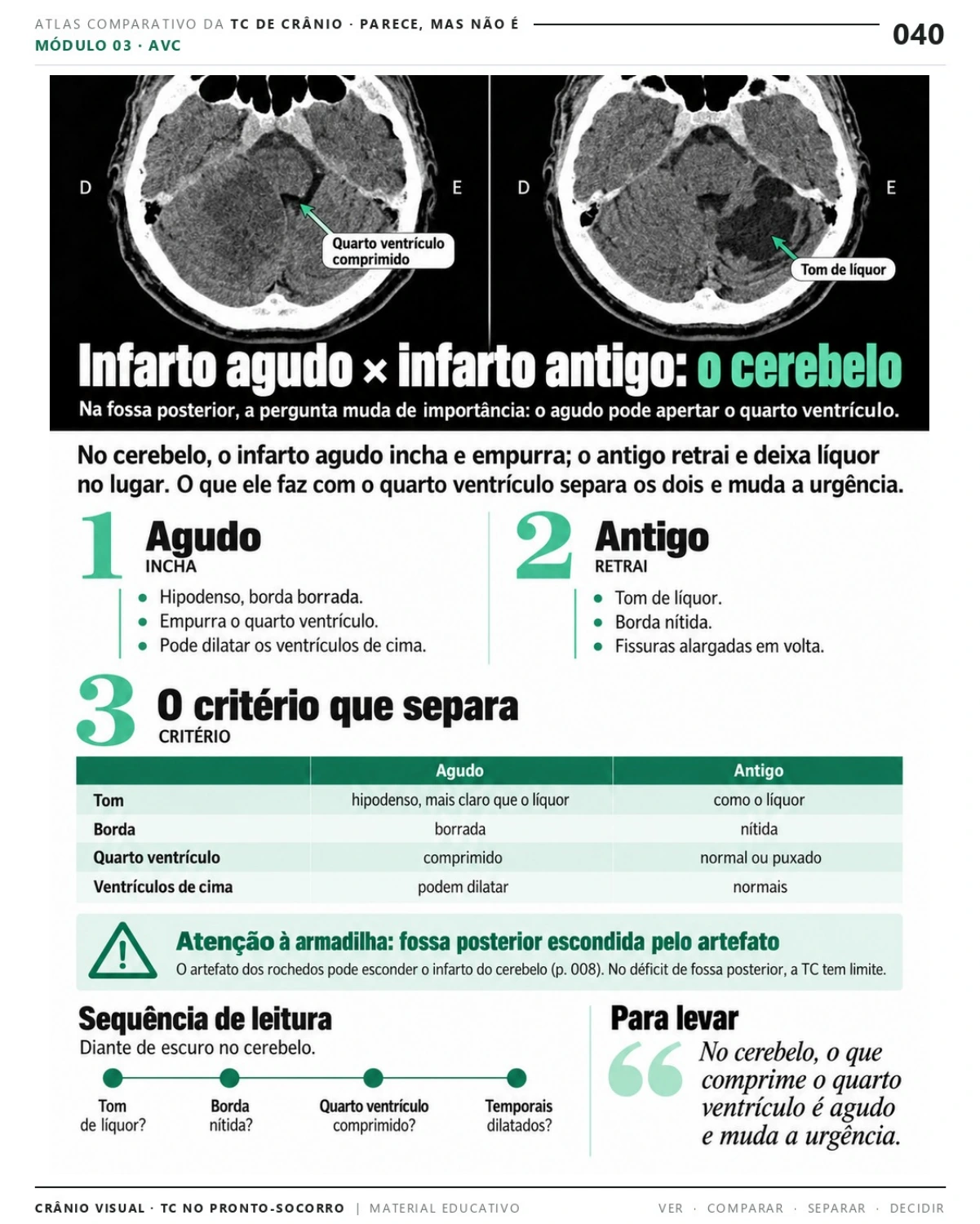 Página 40: Infarto agudo × antigo: cerebelo. Prévia do PDF Crânio Visual TC; imagens didáticas simuladas.