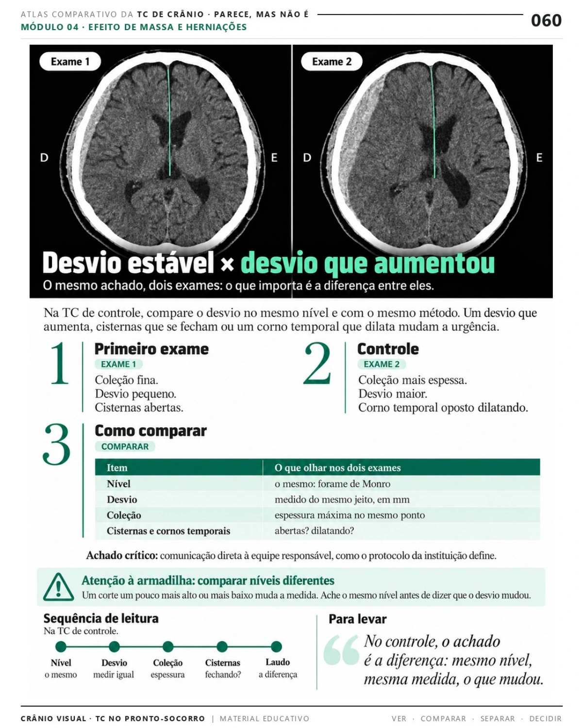 Página 60: Desvio estável × desvio que aumentou. Prévia do PDF Crânio Visual TC; imagens didáticas simuladas.