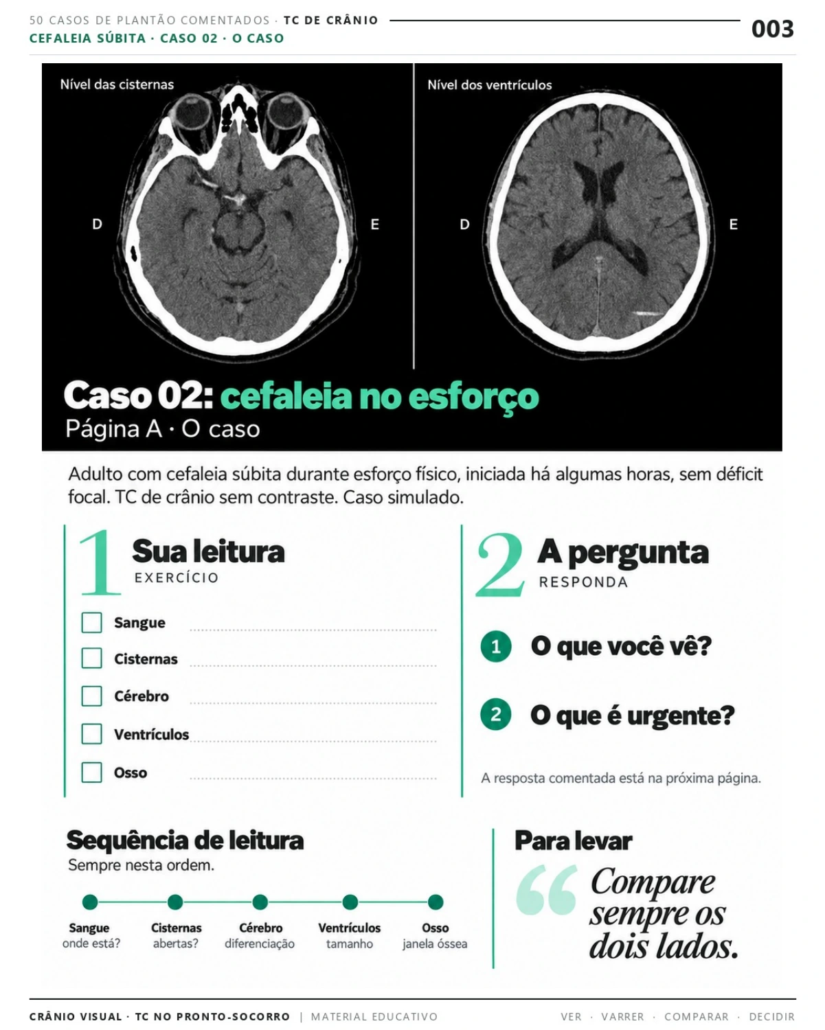 Página 3: Caso 02: cefaleia no esforço. Prévia do PDF Crânio Visual TC; imagens didáticas simuladas.