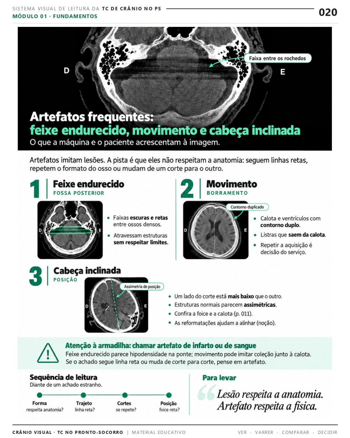Página 20: Artefatos: técnica, movimento e posição. Prévia do PDF Crânio Visual TC; imagens didáticas simuladas.